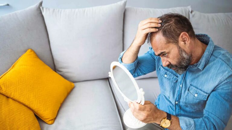 علاج الصلع الوراثي