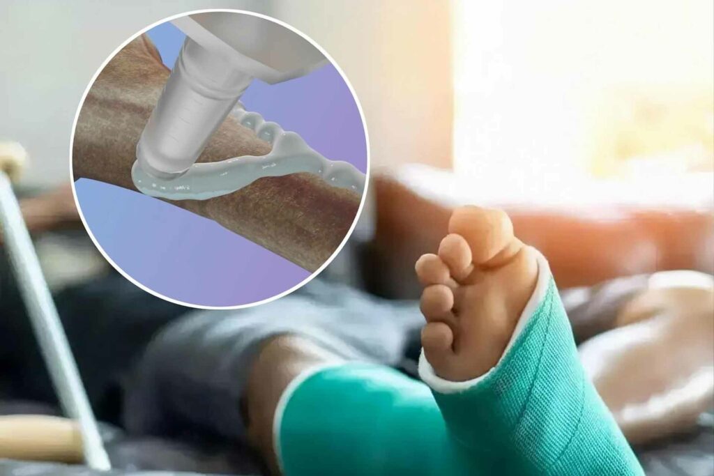 غراء العظام