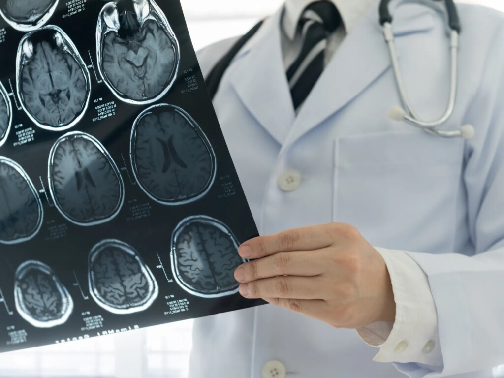 خطأ طبي كارثي في اليابان: جراح تجاهل نتائج الفحص وأزال أنسجة سليمة بالدماغ